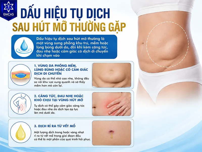 Dấu hiệu tụ dịch sau hút mỡ thường là một vùng sưng phồng khu trú, mềm hoặc lùng bùng dưới da, đôi khi kèm căng tức, đau nhẹ