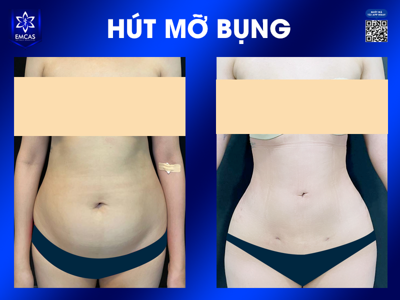 Những Phương Pháp Thu Gọn Vòng 2