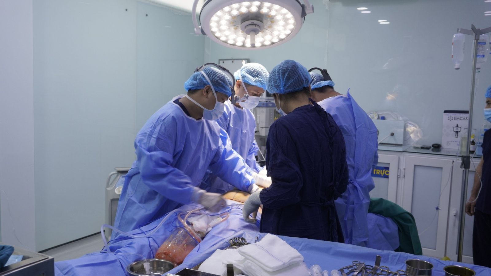 Các công nghệ hút mỡ hiện nay