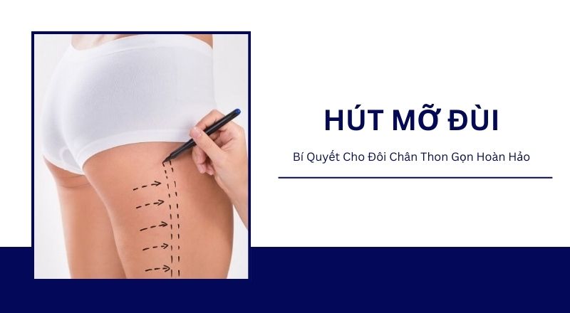 Hút Mỡ Đùi - Bí Quyết Cho Đôi Chân Thon Gọn Hoàn Hảo