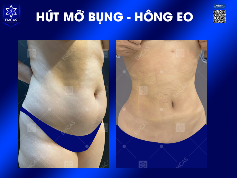 Những Cách Giảm Cân Sau Tết