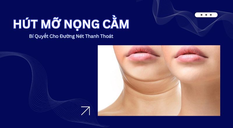 Hút Mỡ Nọng Cằm - Bí Quyết Cho Đường Nét Thanh Thoát