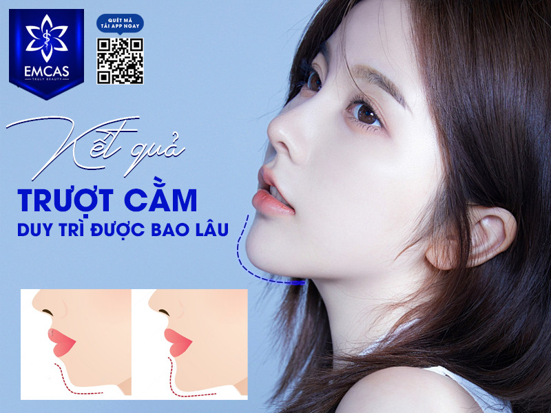 Trượt Cằm Và Những Điều Cần Biết