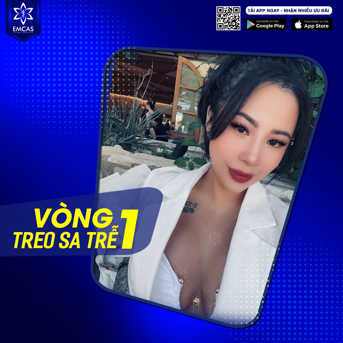 Cấp Độ Sa Trễ Của Ngực Và Kỹ Thuật Khắc Phục