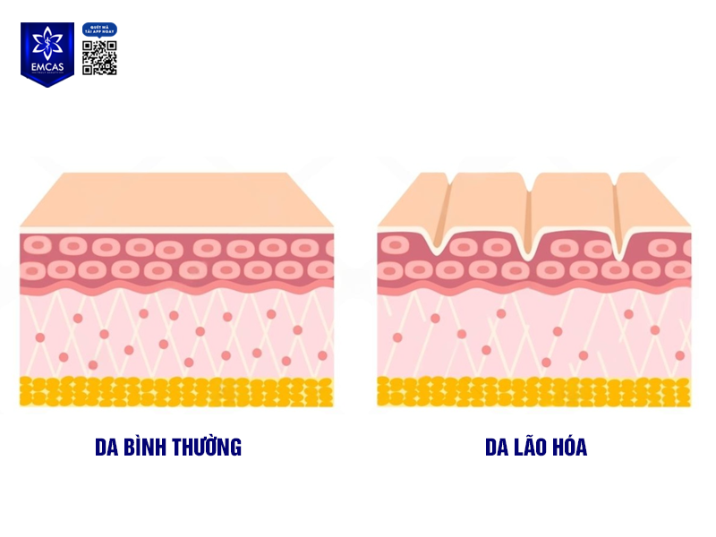 Cách Phòng Ngừa Và Điều Trị Lão Hóa Da Hiệu Quả