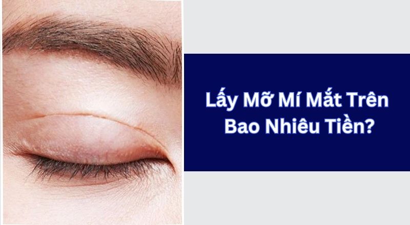 Lấy Mỡ Mí Mắt Trên Bao Nhiêu Tiền?