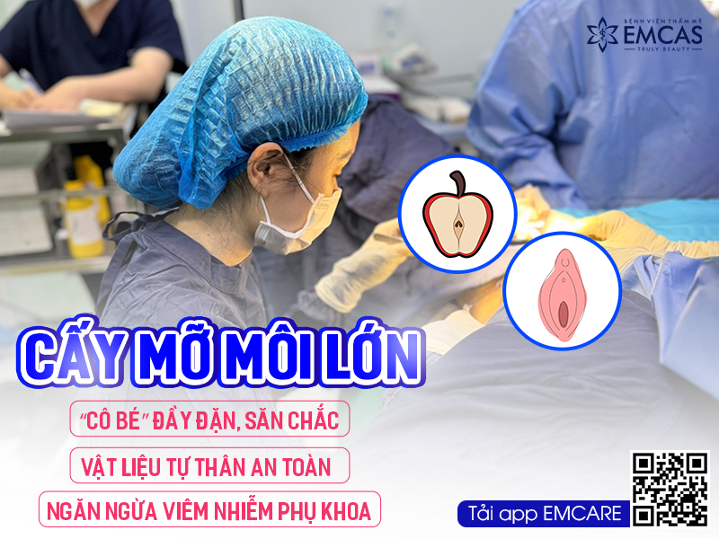CẤY MỠ MÔI LỚN