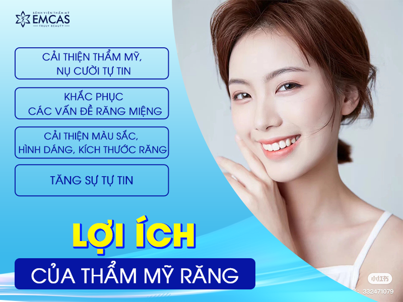 Có Nên Thẩm Mỹ Răng Hay Không?