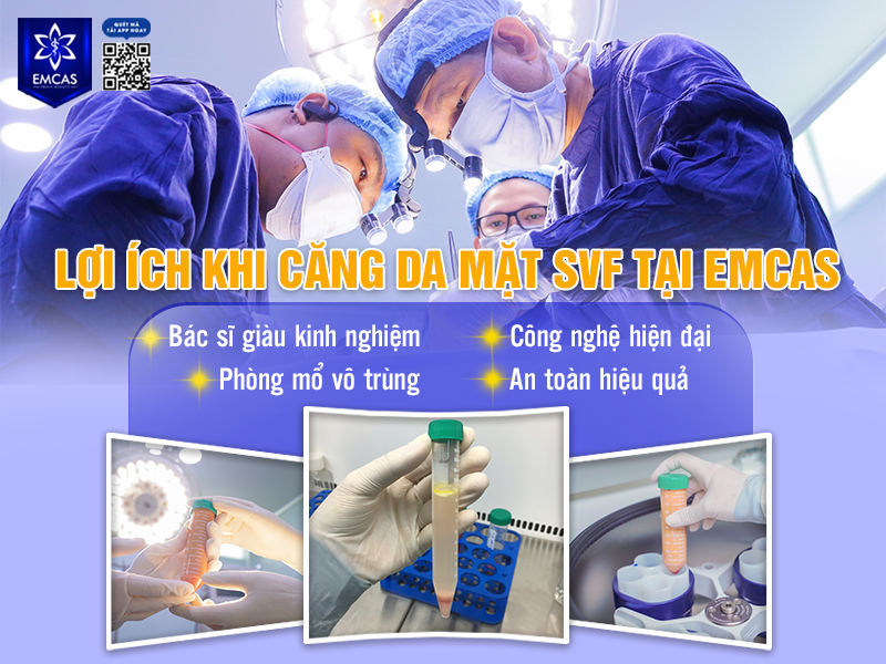  Lợi Ích Khi Căng Da Mặt SVF Tại EMCAS
