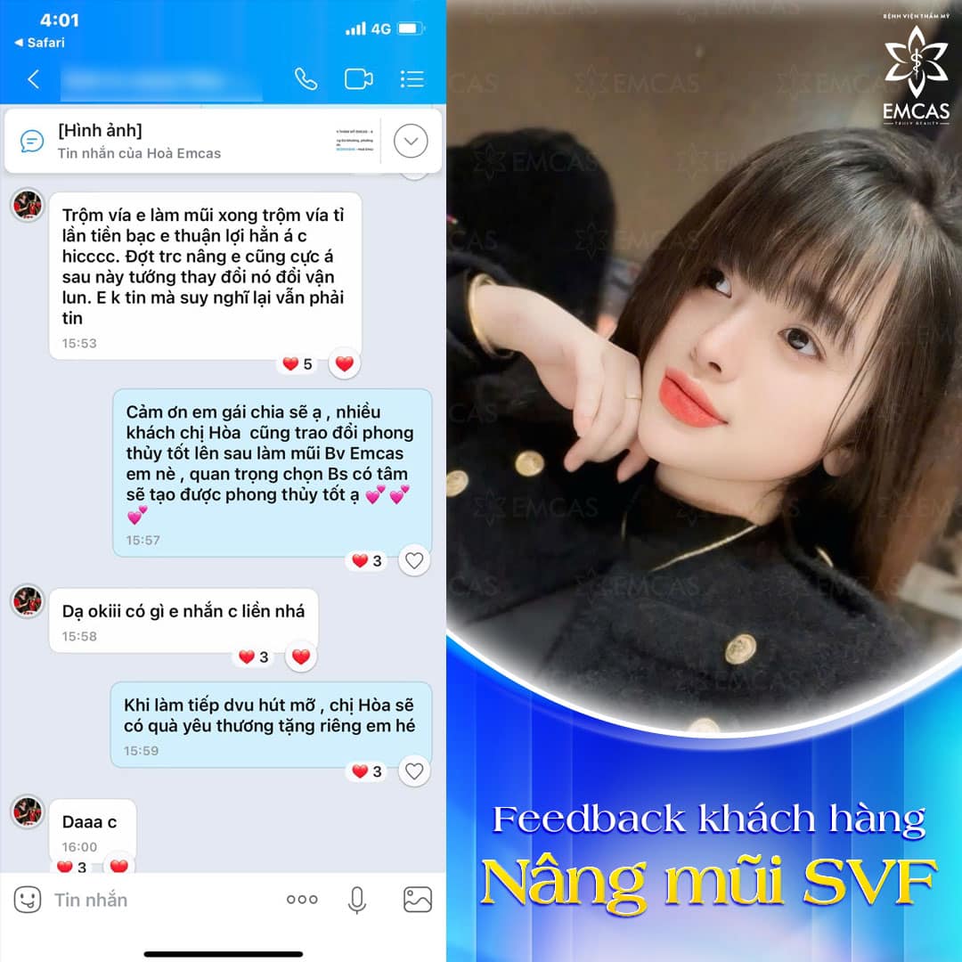 Lựa Chọn Nào Cho Người Nâng Mũi Lần 2?