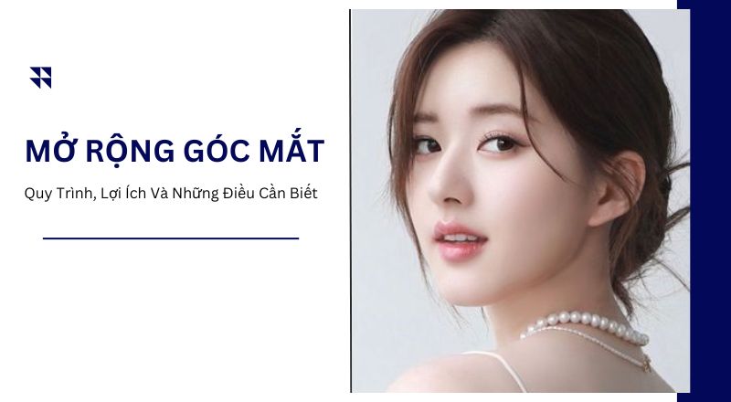 Phẫu Thuật Mở Rộng Góc Mắt Và Những Điều Cần Biết