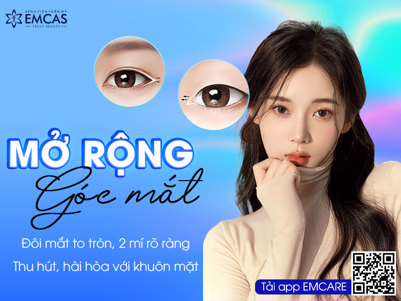 MỞ RỘNG GÓC MẮT