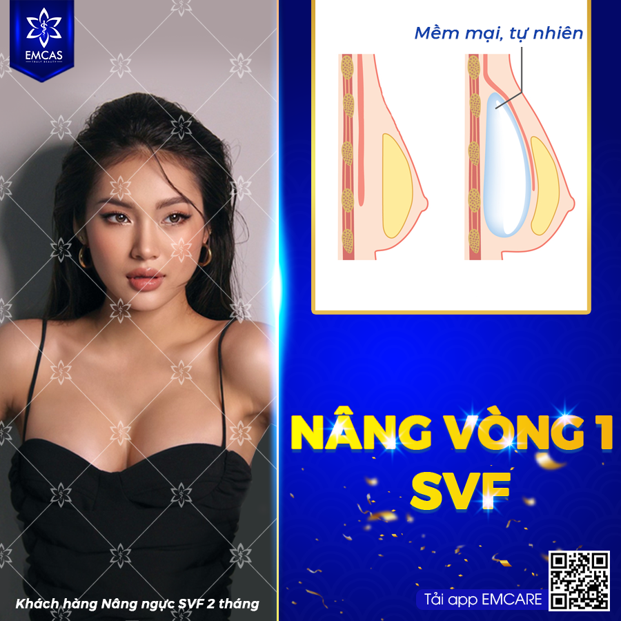 NÂNG NGỰC SVF