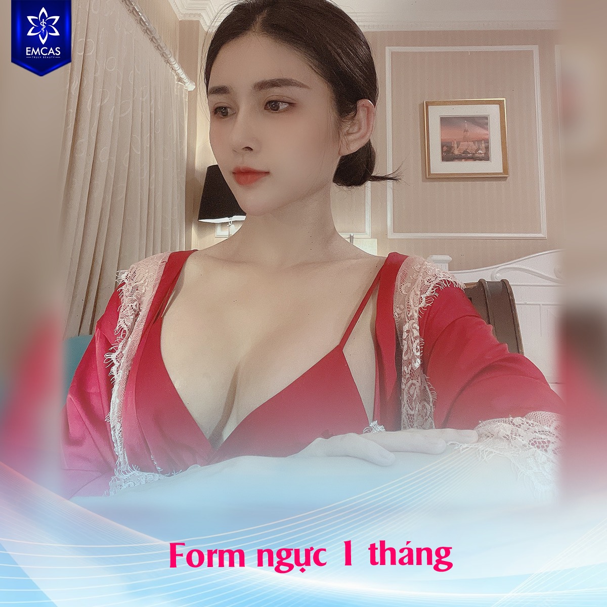 NÂNG NGỰC SVF