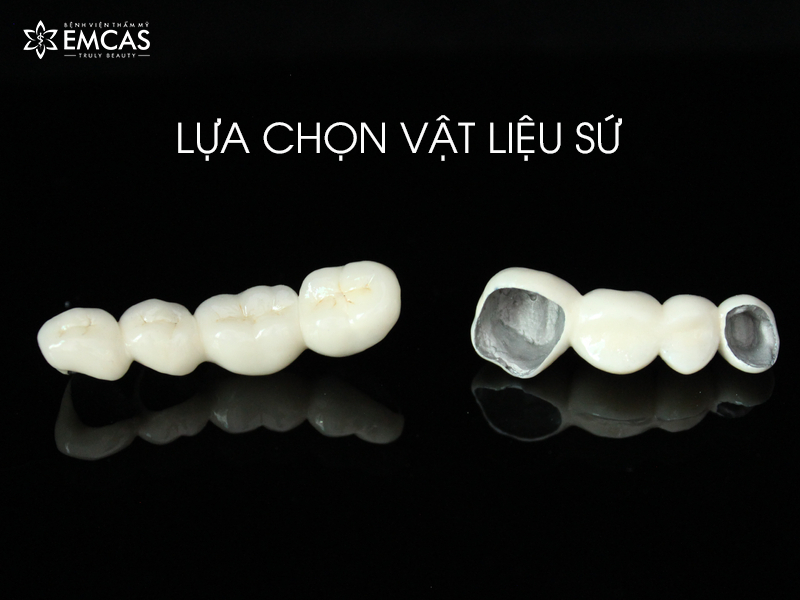 Bọc Răng Sứ Là Gì? 