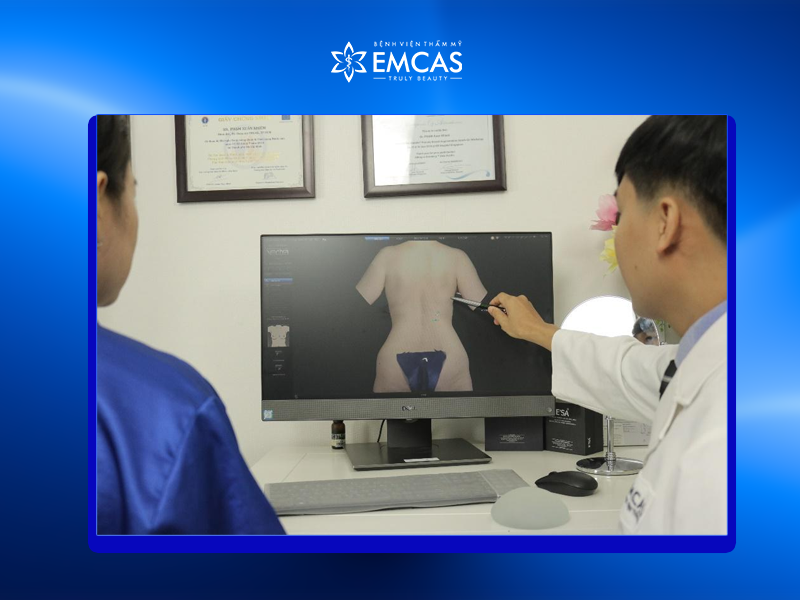 Khi Nào Nên Chọn Nâng Mông Bằng Túi Độn?