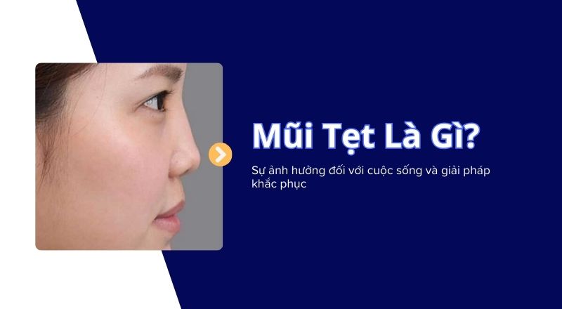 Mũi Tẹt Là Gì? Ảnh Hưởng Đối Với Cuộc Sống Và Giải Pháp Khắc Phục