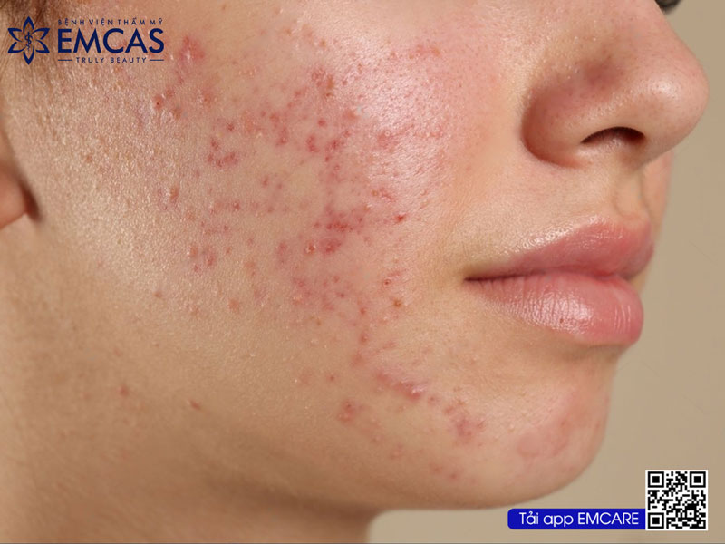 Những Vấn Đề Của Làn Da Và Phương Pháp Điều Trị