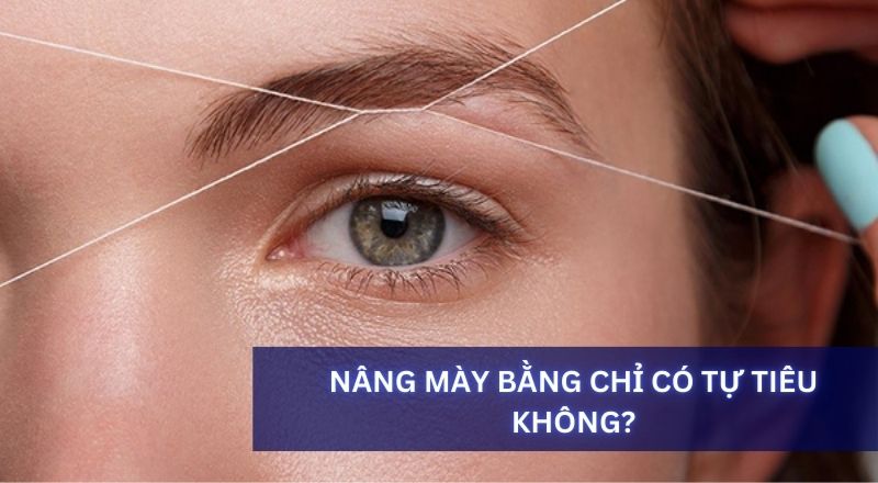 Nâng Chân Mày Bằng Chỉ Có Tự Tiêu Không?