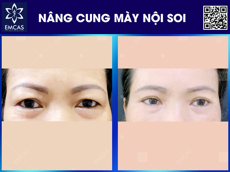 NÂNG CUNG MÀY NỘI SO