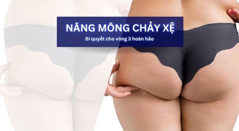 Nâng Mông Chảy Xệ - Bí Quyết Cho Vòng 3 Hoàn Hảo