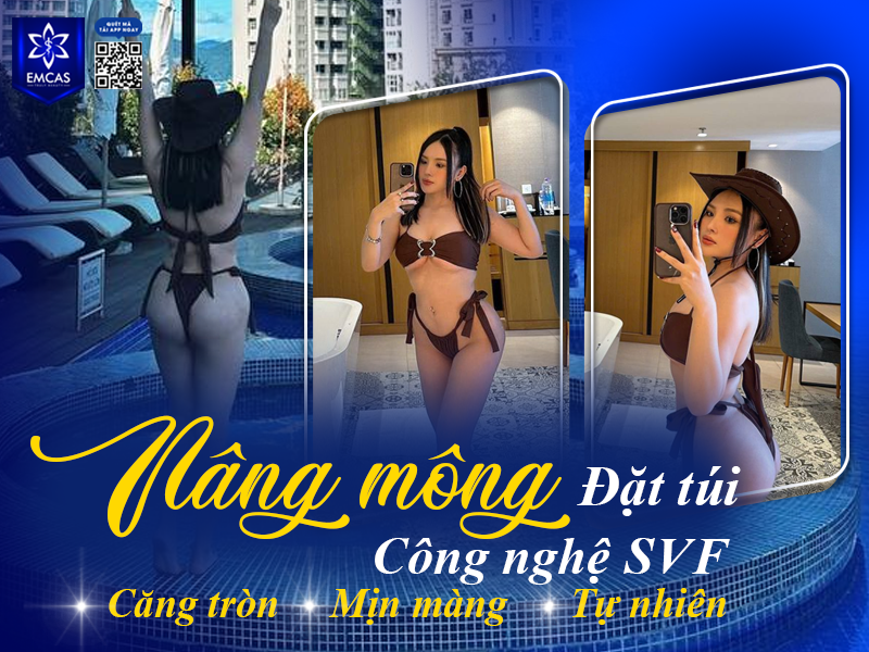 Nâng Mông Có Ảnh Hưởng Đến Việc Ngồi Hay Đi Lại Không?