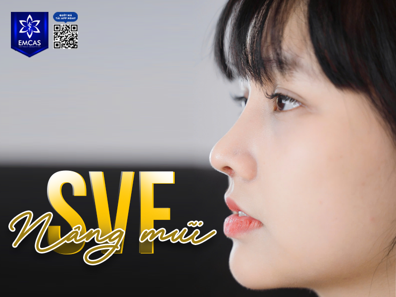 Lý Do Nên Chọn Nâng Mũi SVF Thay Vì Phương Pháp Truyền Thống