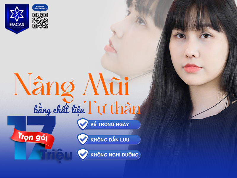 NÂNG MŨI TỰ THÂN – TRỌN GÓI 17 TRIỆU ĐỒNG