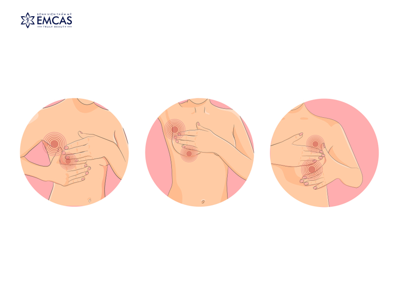 Các Loại Nâng Ngực: Nên Chọn Loại Nào?
