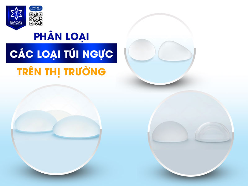 Hiện nay, các túi ngực được sản xuất với nhiều đặc điểm khác nhau nhằm đáp ứng nhu cầu đa dạng về thẩm mỹ, độ an toàn và khả năng tương thích sinh học.