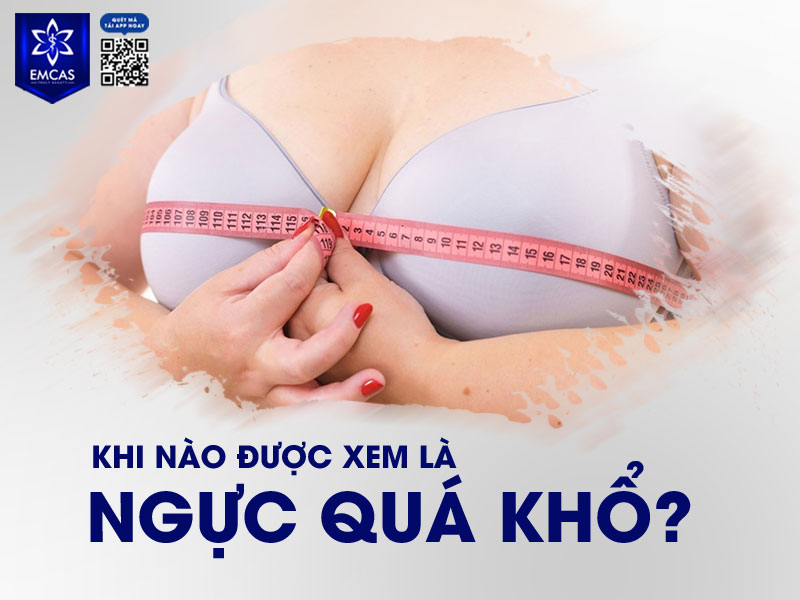 Ngực được xem là quá khổ khi kích thước bầu ngực vượt quá sự cân đối tự nhiên với tổng thể vóc dáng, gây ảnh hưởng đến thẩm mỹ, sức khỏe và sinh hoạt hằng ngày.