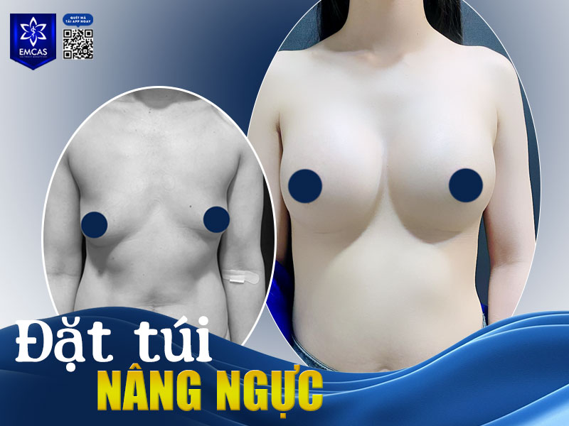 Bệnh Viện Thẩm Mỹ EMCAS là một trong những địa chỉ được nhiều khách hàng tin tưởng với nhiều ưu điểm nổi bật.