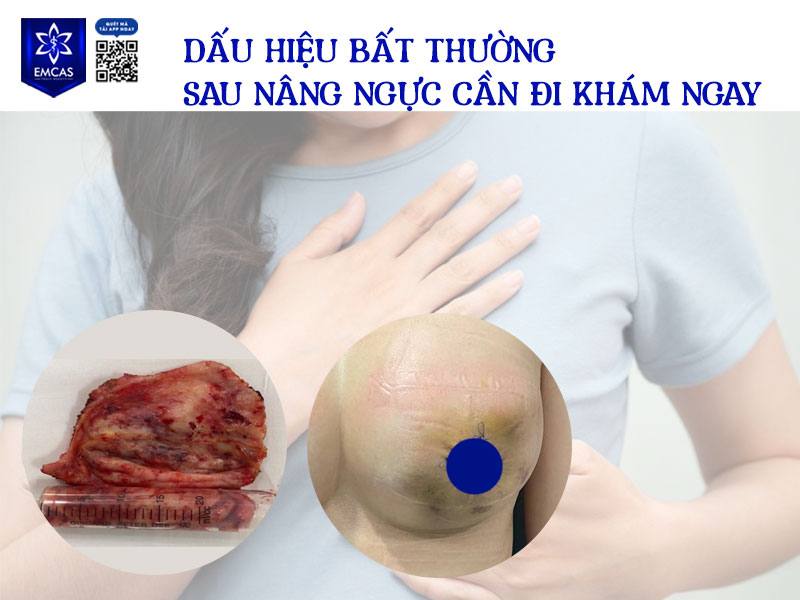Sau phẫu thuật thẩm mỹ vòng 1, phần lớn các phản ứng như sưng nhẹ, căng tức hay khó chịu đều là bình thường và sẽ giảm dần theo thời gian.