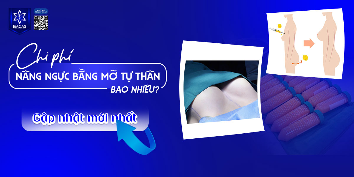 Chi phí nâng ngực bằng mỡ tự thân bao nhiêu? [Cập nhật mới nhất]