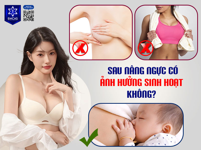 Sau nâng ngực, sinh hoạt hàng ngày chỉ bị ảnh hưởng trong thời gian đầu và sẽ nhanh chóng trở lại bình thường khi cơ thể hồi phục.