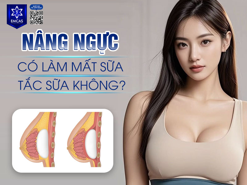 Việc nâng ngực không gây mất sữa nếu phẫu thuật không làm tổn thương tuyến sữa và ống dẫn sữa.