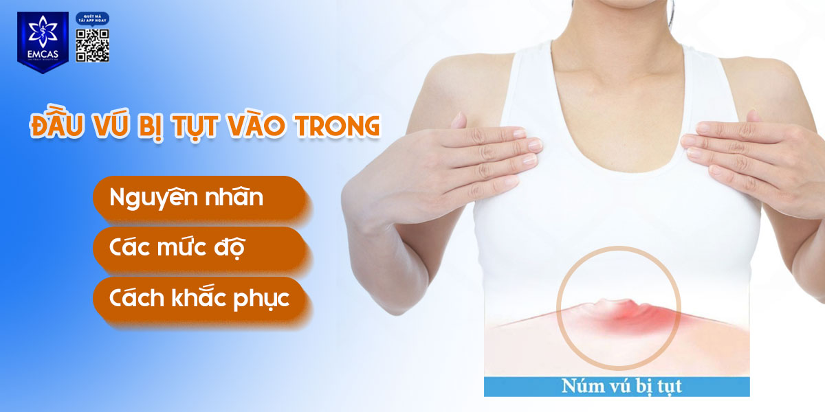 Đầu vú bị tụt vào trong: Nguyên nhân, các mức độ và cách khắc phục