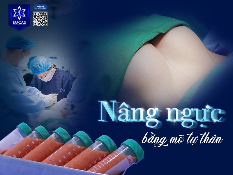 Nâng ngực bằng mỡ tự thân là phương pháp làm đẹp an toàn, tự nhiên nhưng không phải ai cũng phù hợp.