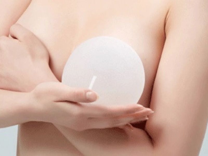 Nâng ngực bằng túi độn là một phương pháp thẩm mỹ sử dụng vật liệu nhân tạo để tăng kích thước và cải thiện hình dáng của ngực.