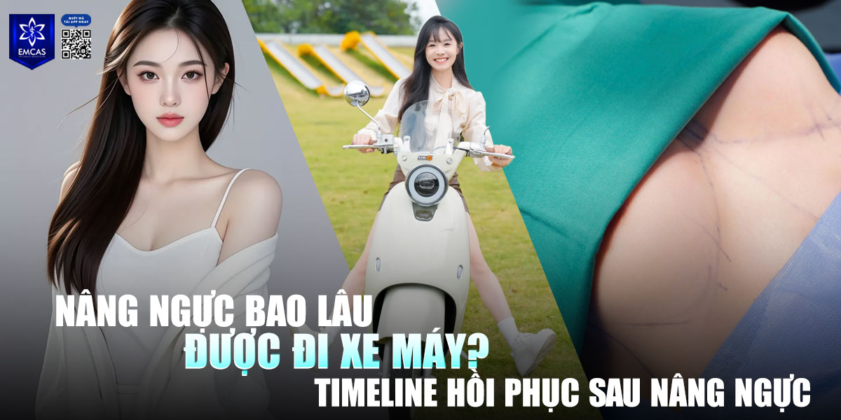 How Long After Breast Augmentation Can You Ride a Motorbike? Recovery Timeline Explained