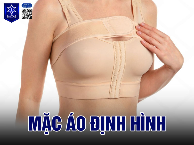 Mặc áo định hình giúp cố định túi ngực đúng vị trí trong khoang đặt, hạn chế xê dịch trong giai đoạn mô mềm còn yếu.
