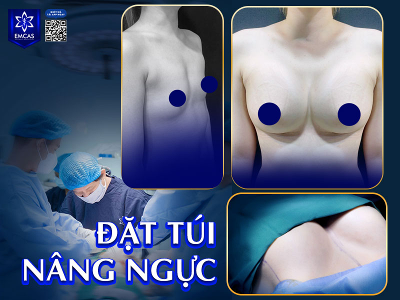 Ngực không có cảm giác đau kéo dài hoặc đau tăng dần là biểu hiện phổ biến trong quá trình hồi phục.