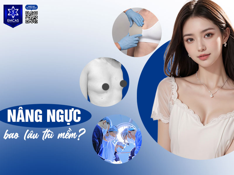 Trung bình sau khoảng 1–3 tháng, vòng 1 sẽ bắt đầu mềm dần và giảm các cảm giác căng cứng ban đầu.
