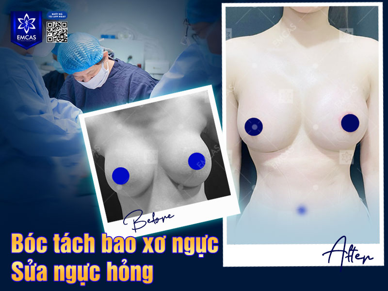 Với các trường hợp ngực bị hỏng, yếu tố bác sĩ đóng vai trò đặc biệt quan trọng.