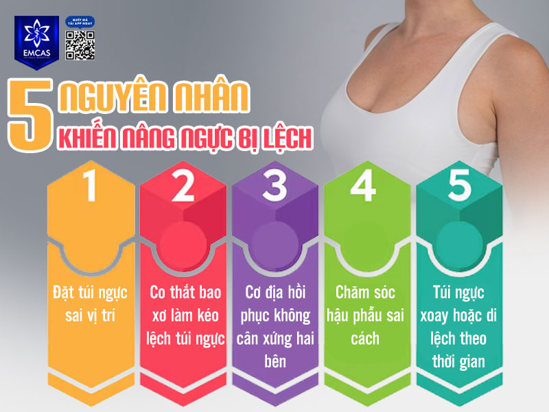 Nâng ngực bị lệch: Nguyên nhân, cách nhận biết & xử lý hiệu quả