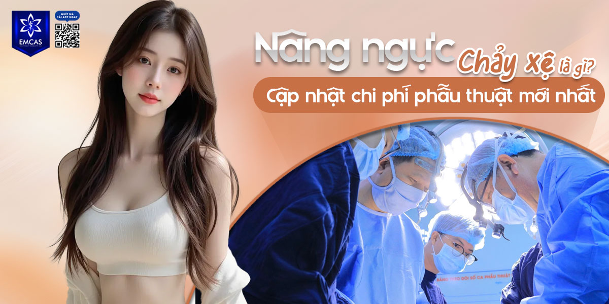 Nâng ngực chảy xệ là gì? Cập nhật chi phí phẫu thuật mới nhất