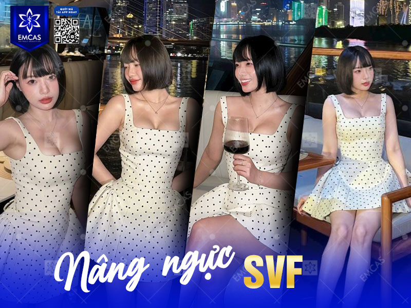 Để đảm bảo an toàn và không ảnh hưởng đến khả năng cho con bú, bạn nên lưu ý một số vấn đề trước và sau khi nâng ngực.