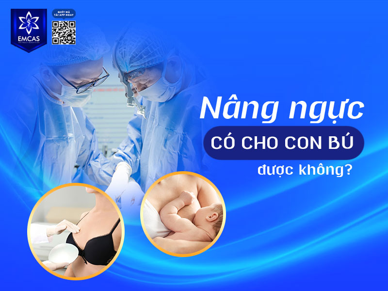 Phẫu thuật đặt túi ngực thông thường không làm gián đoạn hệ thống tuyến sữa, đặc biệt khi thực hiện bởi bác sĩ có chuyên môn và lựa chọn đường mổ phù hợp.