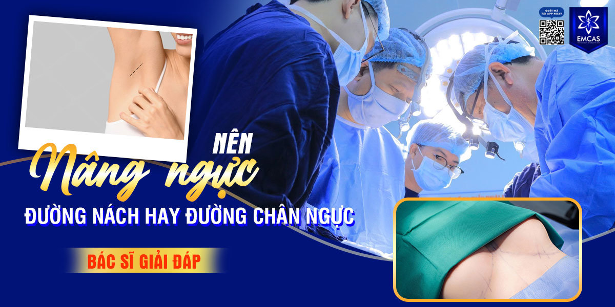 Nâng ngực đường nách và những điều cần biết