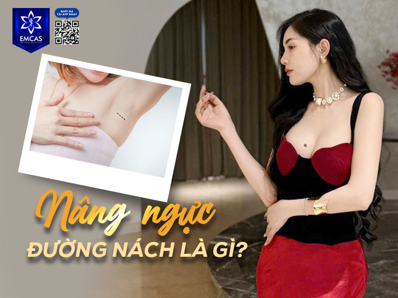 Nâng ngực đường nách là phương pháp phẫu thuật đặt túi độn ngực thông qua một đường rạch nhỏ tại vùng nếp gấp dưới cánh tay.